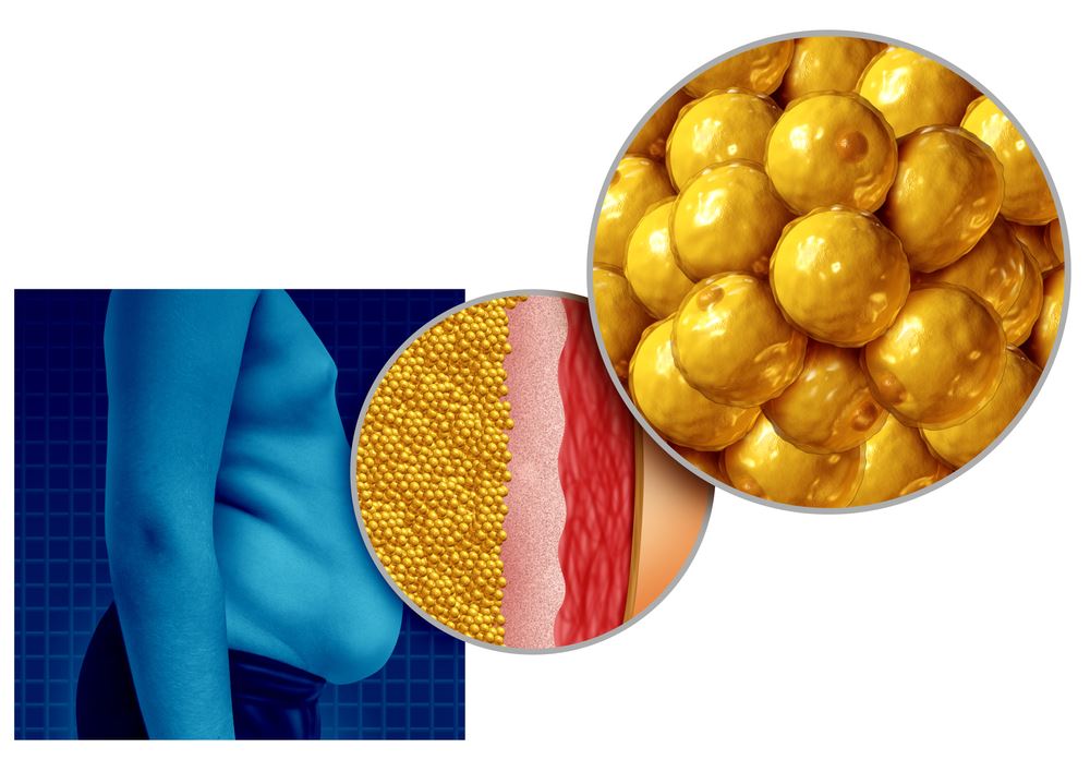 giảm cholesterol